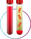tumor issue sample